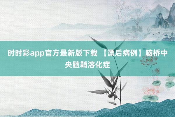 时时彩app官方最新版下载 【漂后病例】脑桥中央髓鞘溶化症